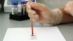 Жители региона смогут сдать платные тесты на коронавирус в центре СПИДа в Белгороде